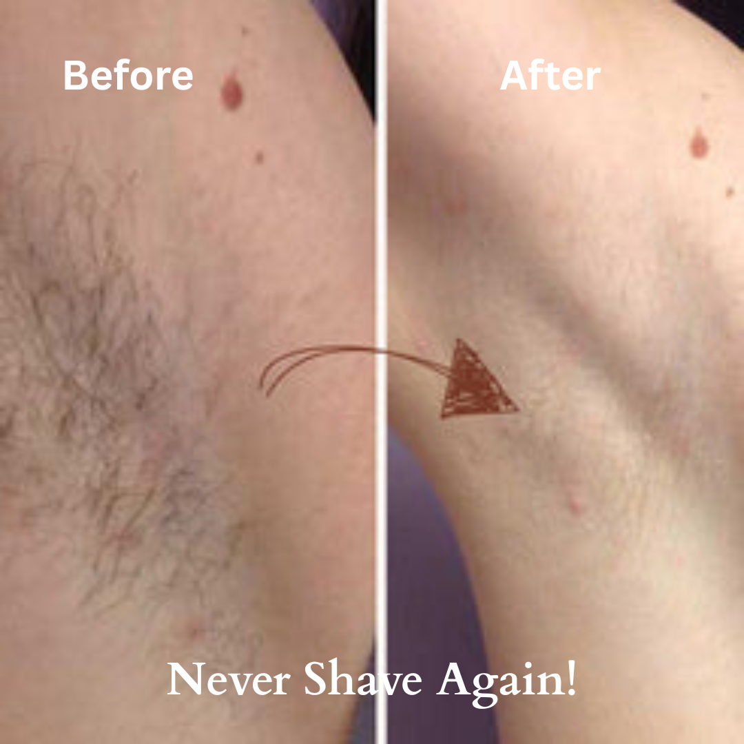 Venaria™ IPL Permanent Hair Remover – Better Than £3,000 Salons