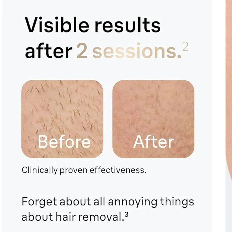 SilkySmooth™ Hair Removal System™