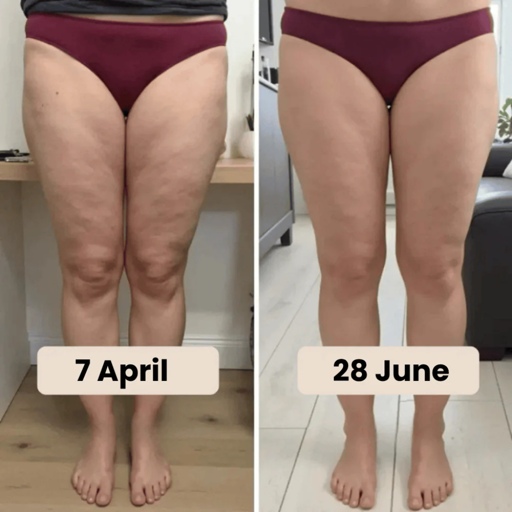 Venaria Anti-Cellulite Sculpt 3D Leggings – Sehen Sie in Sekunden schlanker, glatter & gestrafft aus