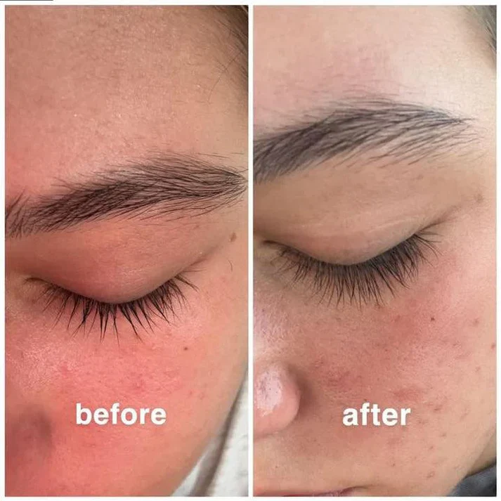 Cosmic Eyelash Serum: This year's Must-Have Fuller Lashes